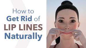 how to get rid of lip lines naturally