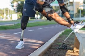 De la jambe de bois au genoux électronique : l'histoire de la prothèse de jambe. | APO Orthopedie Muret