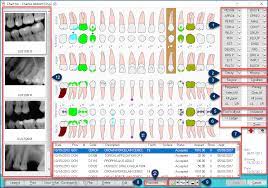 tooth chart overview