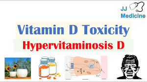 vitamin d toxicity hypervitaminosis d