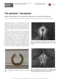the peri horseshoe request pdf