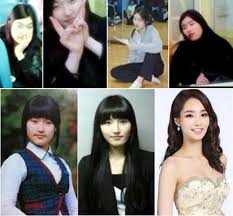 miss korea s plastic surgery scandal