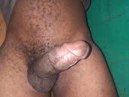 File:Erect circumcised penis - Black Man.jpg - Wikimedia Commons