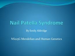 ppt nail patella syndrome powerpoint