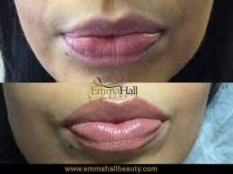 permanent lips emma hall beauty