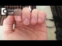 what causes white spots on nails and