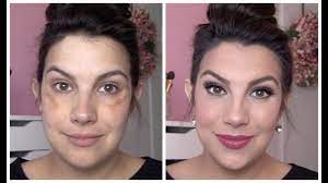 full coverage makeup for melasma