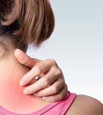 heat rash in s causes treatment