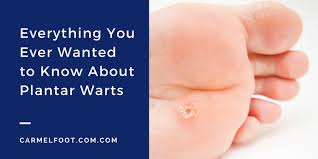 A plantar wart, or verruca, is a wart occurring on the bottom of the foot or toes. What You Should Know About Plantar Warts Carmel Foot Specialists