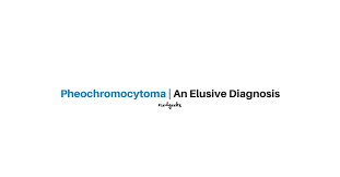 Pheochromocytoma An Elusive Diagnosis Physician Assistant Boards