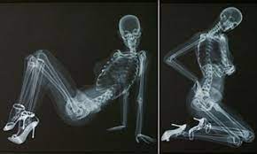 XXX rated calendar: Pin-up shows off her skeleton in series of x-ray poses  | Daily Mail Online