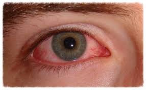 Image result for eye care