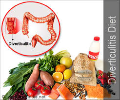 Diverticulitis Diet Diet To Beat Diverticulis