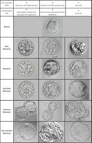 Choosing Embryos For Transfer Or Freezing Fertility Solutions