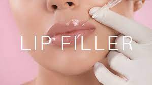lip filler swelling ses 5 facts