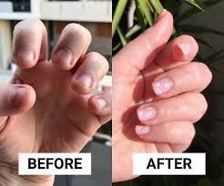 how to stop nail biting after 20 years