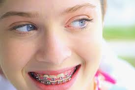 Orthodontic services include things like braces and other specialty dental treatments to help straighten teeth. Orthodontic Care For Adults How To Pay For Braces