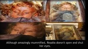 Rosalia was born on december 13, 1918 and died on december 6, 1920 of pneumonia. Is Child Mummy Rosalia Lombardo Opening Her Eyes Video Dailymotion