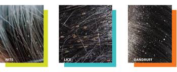 about head lice information for
