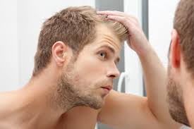55 top männer frisuren geheimratsecken. Tipps Fur Gute Frisuren Fur Geheimratsecken