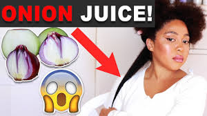 onion juice for mive hair growth