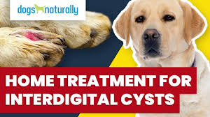 home treatment for interdigital cysts