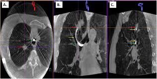 efficacy and safety of cone beam ct