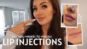 lip injections before during and