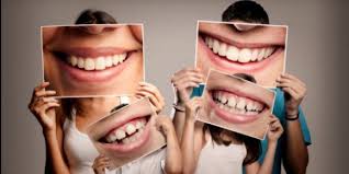 Before using any remedy for teeth whitening, it is better to get acquainted with the symptoms holy basil is also a natural remedy for whitening teeth. Aluminum Foil Teeth Whitening And Diy Hacks That Harm Teeth