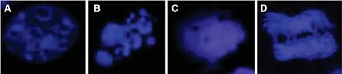 Analyzing Cell Death By Nuclear Staining With Hoechst 33342