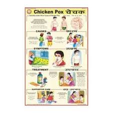 Chicken Pox View Specifications Details Of Medical Chart