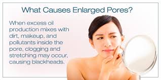 enlarged pores