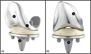 design and rationale of the attune knee