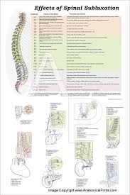 Effects Of Spinal Subluxation Poster 24 X 36