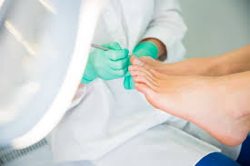 can fungal nail infection spread apotheco