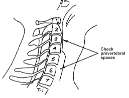 X Ray Skills 2 Cervical Spine X Ray Interpretation