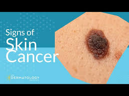 skin cancer screening symptoms types