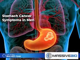 Jaundice (yellowing of eyes and skin) buildup of fluid, or swelling, in the abdominal area. Stomach Cancer Symptoms In Men Why Does Stomach Cancer Occur