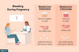 implantation bleeding vs miscarriage