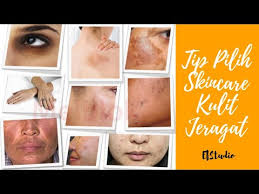 Bagi anda yang ingin mengatasi jerawat dengan biaya yang murah. Tips Pilih Skincare Kulit Jeragat By Nurul Aziyana