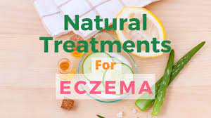 natural treatment eczema natural