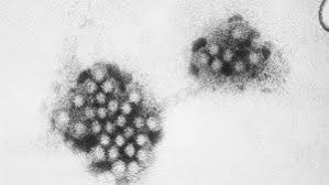 increasing norovirus cases
