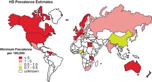 huntington disease prevalence