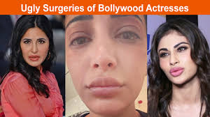 ugly surgeries of bollywood actresses