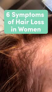 hair loss in women symptoms causes