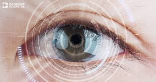 cataract surgery and intraocular lens