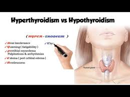 hyperthyroidism vs hypothyroidism you