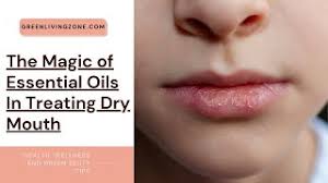 essential oils in treating dry mouth