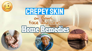 crepey skin on arms face and legs