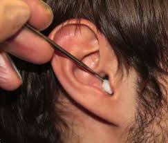 Image result for foreign body in ear
